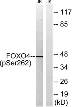 FoxO4 (phospho Ser262) Rabbit Polyclonal Antibody | 兔多抗 | EnkiLife恩玑生命