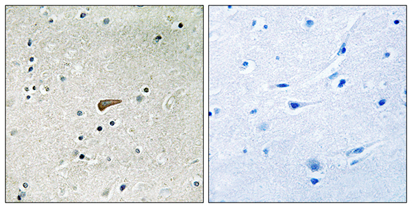 FRS2 (phospho Tyr436) Rabbit Polyclonal Antibody | 兔多抗 | EnkiLife恩玑生命