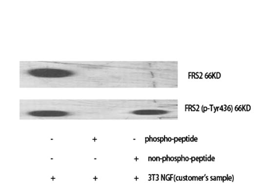 FRS2 (phospho Tyr436) Rabbit Polyclonal Antibody | 兔多抗 | EnkiLife恩玑生命