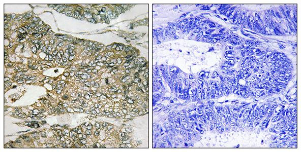 Gab 2 (phospho Ser159) Rabbit Polyclonal Antibody | 兔多抗 | EnkiLife恩玑生命