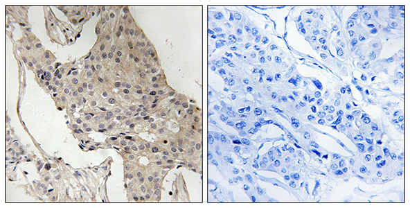 Gab 2 (phospho Ser623) Rabbit Polyclonal Antibody | 兔多抗 | EnkiLife恩玑生命