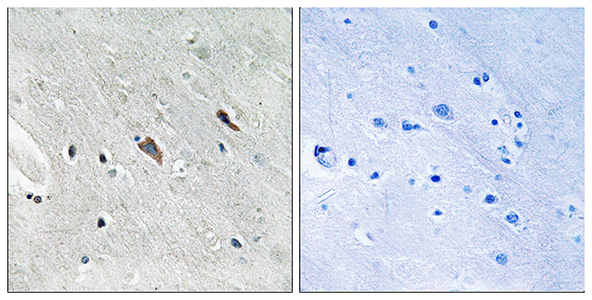 Gab 2 (phospho Tyr643) Rabbit Polyclonal Antibody | 兔多抗 | EnkiLife恩玑生命