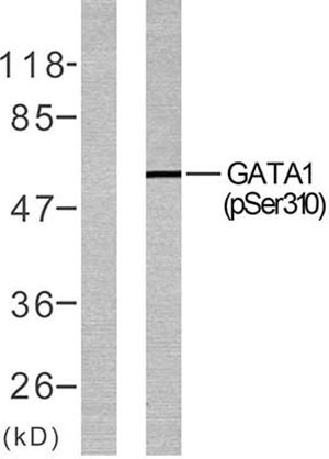 GATA-1 (phospho Ser310) Rabbit Polyclonal Antibody | 兔多抗 | EnkiLife恩玑生命