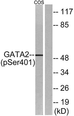 GATA-2 (phospho Ser401) Rabbit Polyclonal Antibody | 兔多抗 | EnkiLife恩玑生命