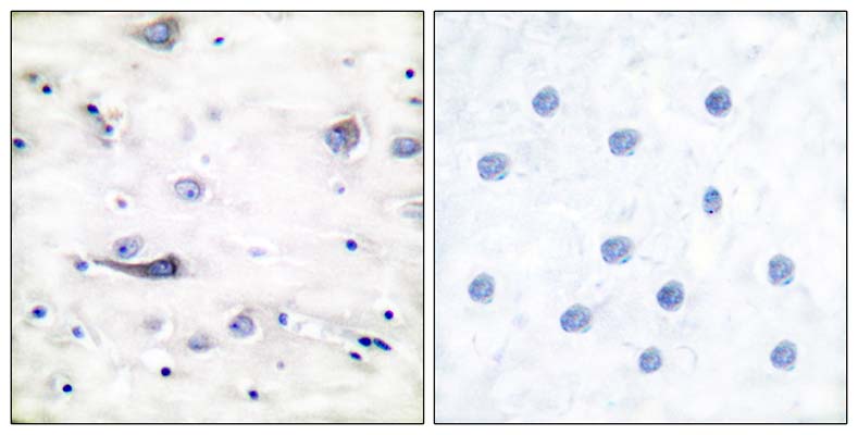 GluR-1 (phospho Ser863) Rabbit Polyclonal Antibody | 兔多抗 | EnkiLife恩玑生命