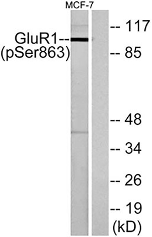 GluR-1 (phospho Ser863) Rabbit Polyclonal Antibody | 兔多抗 | EnkiLife恩玑生命