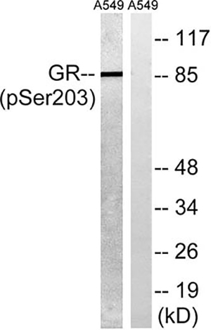 GR (phospho Ser203) Rabbit Polyclonal Antibody | 兔多抗 | EnkiLife恩玑生命