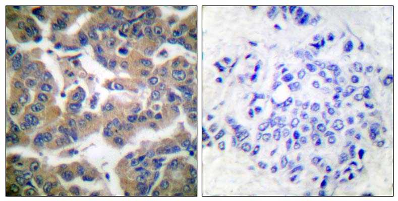 GR (phospho Ser211) Rabbit Polyclonal Antibody | 兔多抗 | EnkiLife恩玑生命