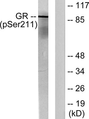 GR (phospho Ser211) Rabbit Polyclonal Antibody | 兔多抗 | EnkiLife恩玑生命