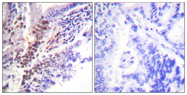 GR (phospho Ser226) Rabbit Polyclonal Antibody | 兔多抗 | EnkiLife恩玑生命