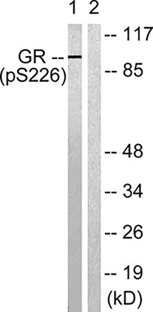 GR (phospho Ser226) Rabbit Polyclonal Antibody | 兔多抗 | EnkiLife恩玑生命
