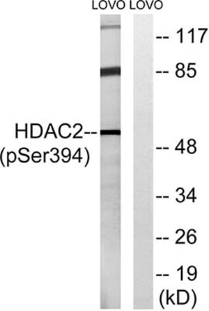 HDAC2 (phospho Ser394) Rabbit Polyclonal Antibody | 兔多抗 | EnkiLife恩玑生命