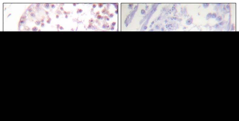 HDAC6 (phospho Ser22) Rabbit Polyclonal Antibody | 兔多抗 | EnkiLife恩玑生命