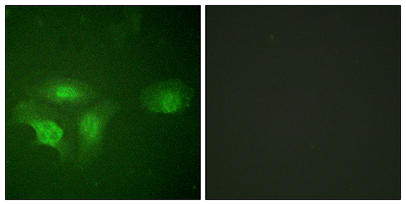 HDAC6 (phospho Ser22) Rabbit Polyclonal Antibody | 兔多抗 | EnkiLife恩玑生命