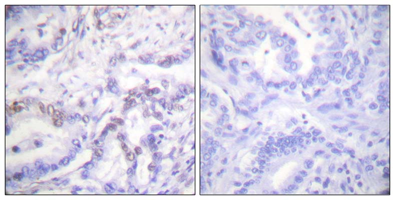 Histone H3 (phospho Thr3) Rabbit Polyclonal Antibody | 兔多抗 | EnkiLife恩玑生命
