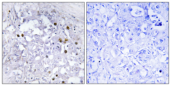 HNF4-α (phospho Ser313) Rabbit Polyclonal Antibody | 兔多抗 | EnkiLife恩玑生命