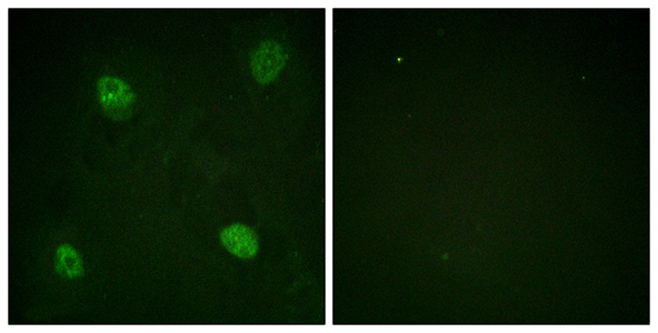 hnRNP D0 (phospho Ser83) Rabbit Polyclonal Antibody | 兔多抗 | EnkiLife恩玑生命