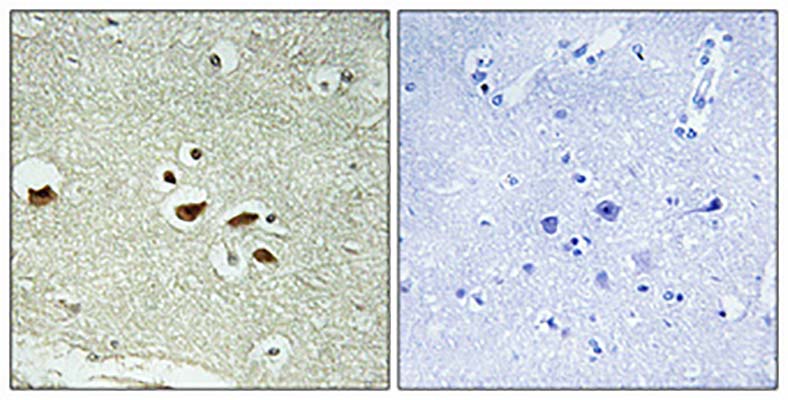 hnRNP K (phospho Ser284) Rabbit Polyclonal Antibody | 兔多抗 | EnkiLife恩玑生命