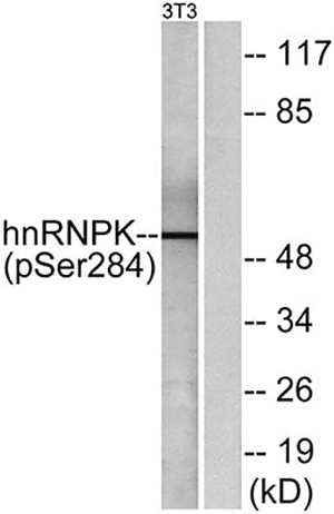 hnRNP K (phospho Ser284) Rabbit Polyclonal Antibody | 兔多抗 | EnkiLife恩玑生命