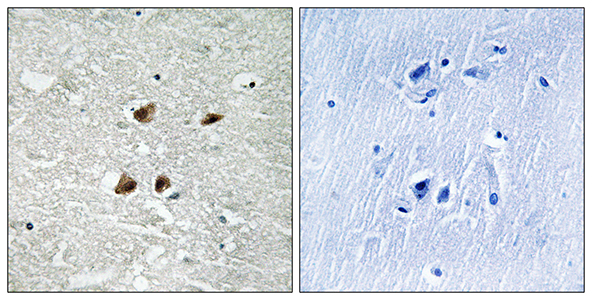 HSF1 (phospho Ser121) Rabbit Polyclonal Antibody | 兔多抗 | EnkiLife恩玑生命
