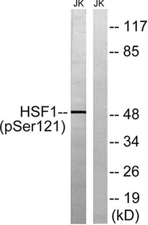 HSF1 (phospho Ser121) Rabbit Polyclonal Antibody | 兔多抗 | EnkiLife恩玑生命