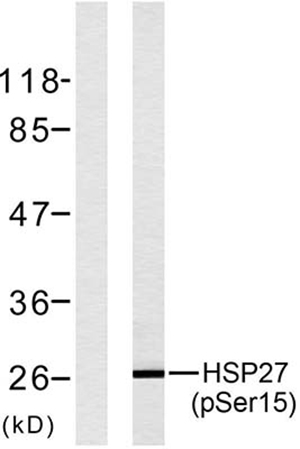 HSP27 (phospho Ser15) Rabbit Polyclonal Antibody | 兔多抗 | EnkiLife恩玑生命
