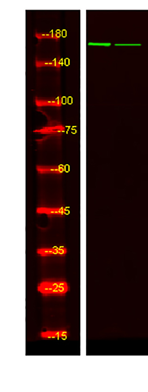 IGF-I Receptor β (phospho-Tyr980)  Rabbit Polyclonal Antibody | 兔多抗 | EnkiLife恩玑生命