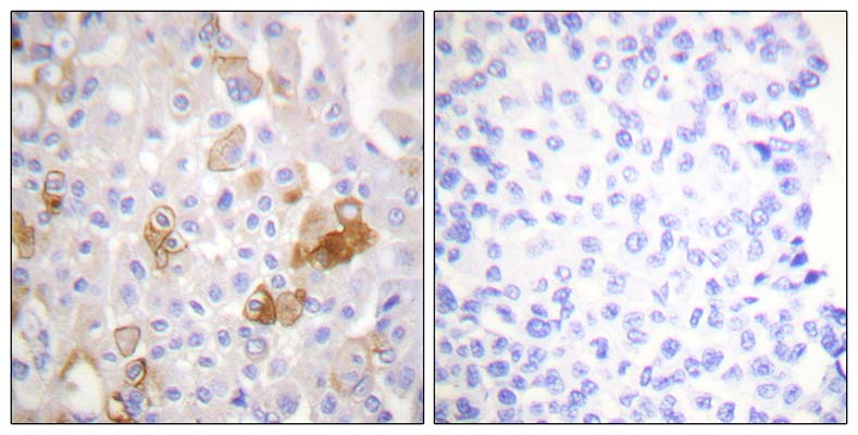 Integrin β1 (phospho Thr788) Rabbit Polyclonal Antibody | 兔多抗 | EnkiLife恩玑生命