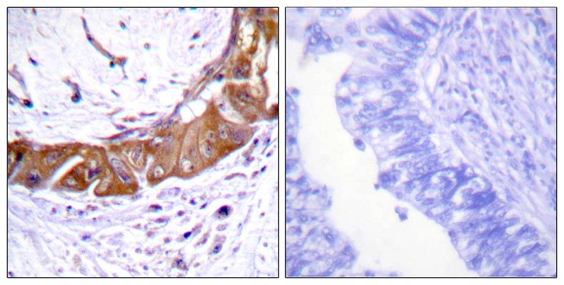 IRAK-1 (phospho Thr100) Rabbit Polyclonal Antibody | 兔多抗 | EnkiLife恩玑生命