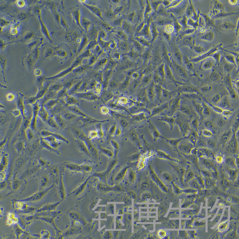 FTC238（人滤泡状甲状腺癌细胞，肺转移）YB-72024HC