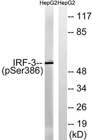 IRF-3 (phospho Ser386) Rabbit Polyclonal Antibody | 兔多抗 | EnkiLife恩玑生命