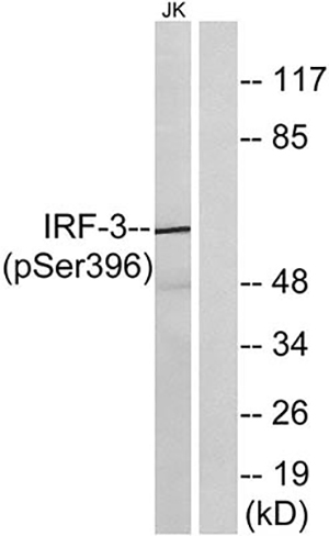 IRF-3 (phospho Ser396) Rabbit Polyclonal Antibody | 兔多抗 | EnkiLife恩玑生命