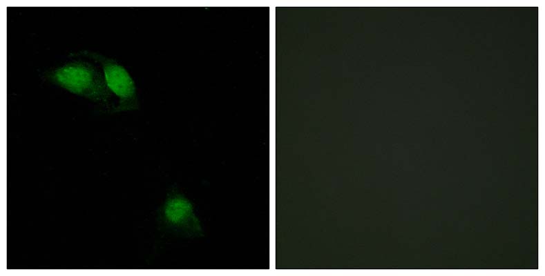 IRS-1 (phospho Ser312) Rabbit Polyclonal Antibody | 兔多抗 | EnkiLife恩玑生命