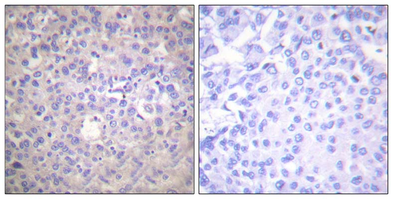 IRS-1 (phospho Ser616) Rabbit Polyclonal Antibody | 兔多抗 | EnkiLife恩玑生命