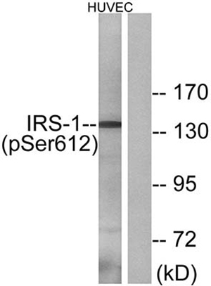 IRS-1 (phospho Ser616) Rabbit Polyclonal Antibody | 兔多抗 | EnkiLife恩玑生命