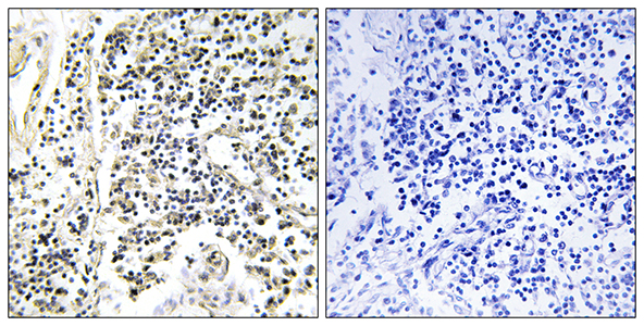 IκB-α (phospho Tyr305) Rabbit Polyclonal Antibody | 兔多抗 | EnkiLife恩玑生命