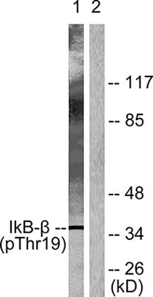 IκB-β (phospho Thr19) Rabbit Polyclonal Antibody | 兔多抗 | EnkiLife恩玑生命