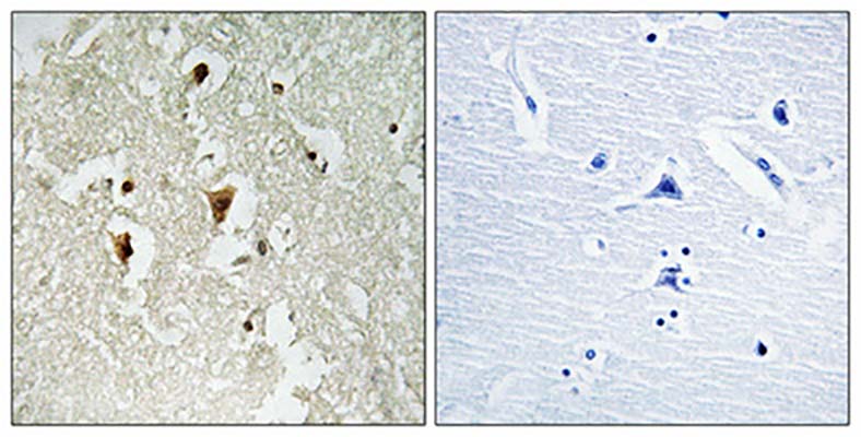 IκB-β (phospho Thr19) Rabbit Polyclonal Antibody | 兔多抗 | EnkiLife恩玑生命