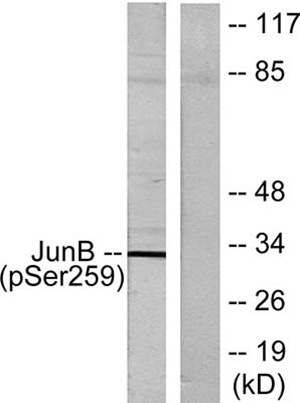 Jun B (phospho Ser259) Rabbit Polyclonal Antibody | 兔多抗 | EnkiLife恩玑生命
