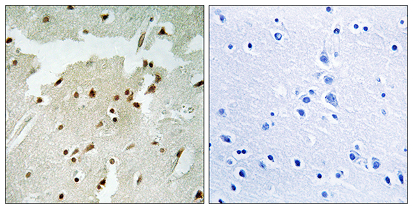 Ku-70 (phospho Ser5) Rabbit Polyclonal Antibody | 兔多抗 | EnkiLife恩玑生命