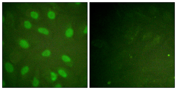 Ku-80 (phospho Thr714) Rabbit Polyclonal Antibody | 兔多抗 | EnkiLife恩玑生命
