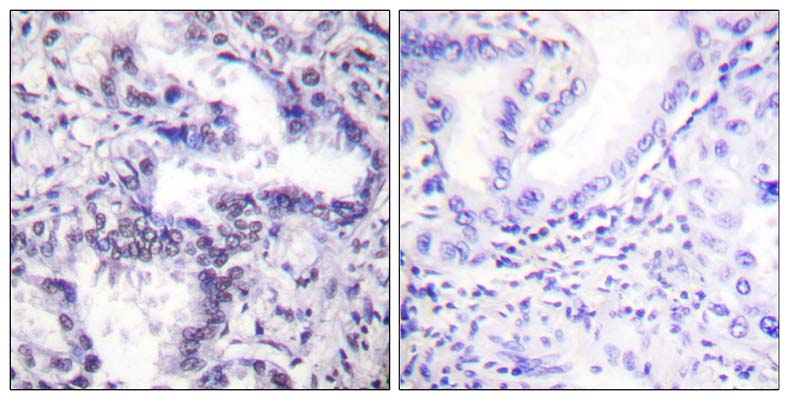 Ku-80 (phospho Thr714) Rabbit Polyclonal Antibody | 兔多抗 | EnkiLife恩玑生命
