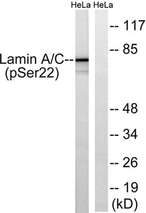 Lamin A/C (phospho Ser22) Rabbit Polyclonal Antibody | 兔多抗 | EnkiLife恩玑生命