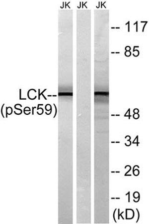 Lck (phospho Ser540) Rabbit Polyclonal Antibody | 兔多抗 | EnkiLife恩玑生命