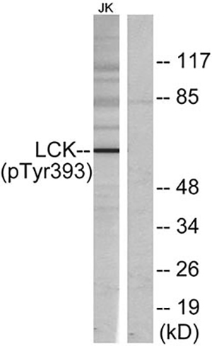 Lck (phospho Tyr393) Rabbit Polyclonal Antibody | 兔多抗 | EnkiLife恩玑生命
