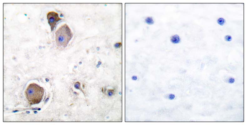 Lyn (phospho Tyr508) Rabbit Polyclonal Antibody | 兔多抗 | EnkiLife恩玑生命