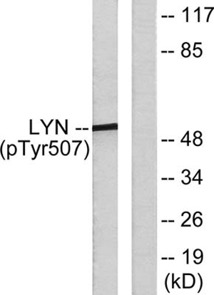 Lyn (phospho Tyr508) Rabbit Polyclonal Antibody | 兔多抗 | EnkiLife恩玑生命