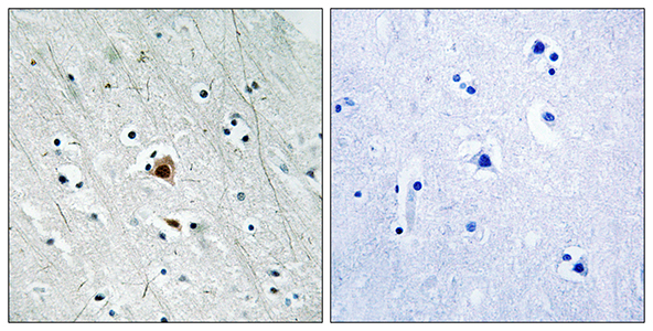 MAPKAPK-2 (phospho Ser272) Rabbit Polyclonal Antibody | 兔多抗 | EnkiLife恩玑生命