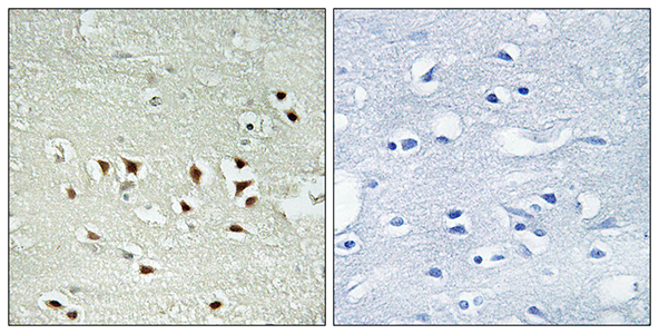 MAPKAPK-2 (phospho Thr334) Rabbit Polyclonal Antibody | 兔多抗 | EnkiLife恩玑生命