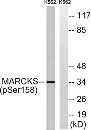 MARCKS (phospho Ser158) Rabbit Polyclonal Antibody | 兔多抗 | EnkiLife恩玑生命